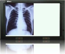 供應柯達激光膠片DVB+ 11X14